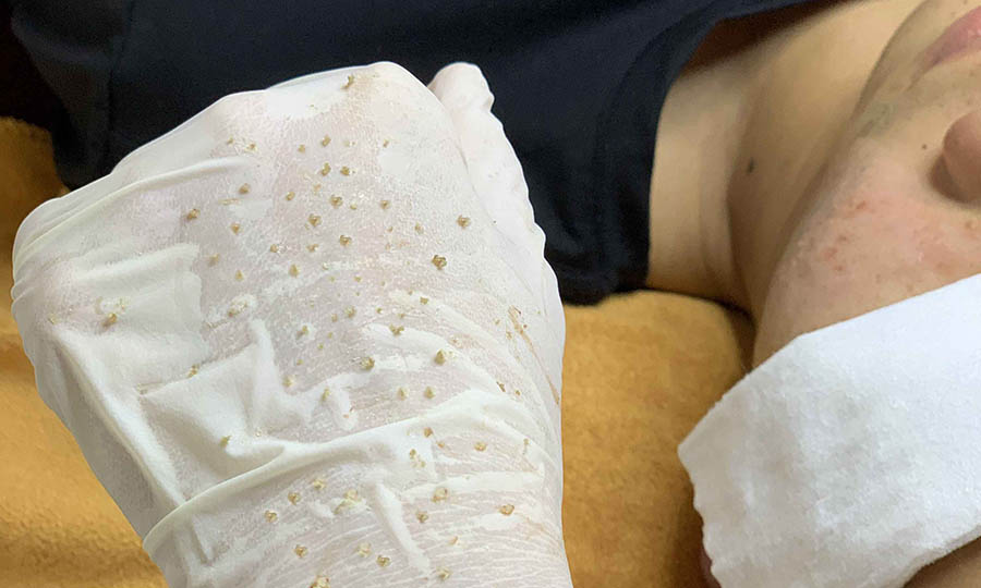 dieu-tri-mun-gia-re-tai-morning-spa-thu-duc